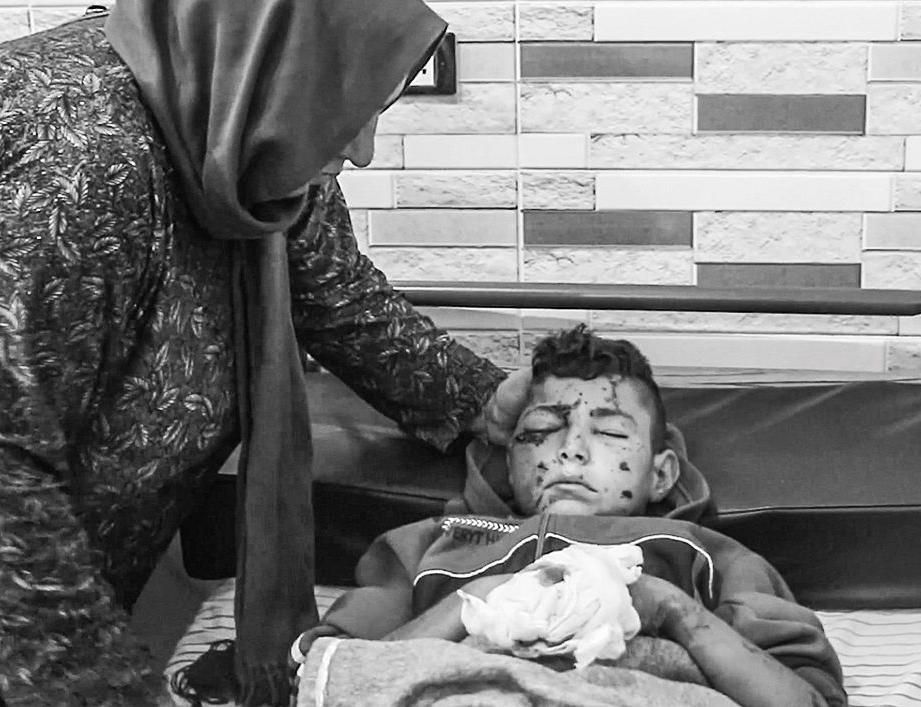 AVC Syrien Bild verletzter Junge AVC Syrien Bild verletzter Junge